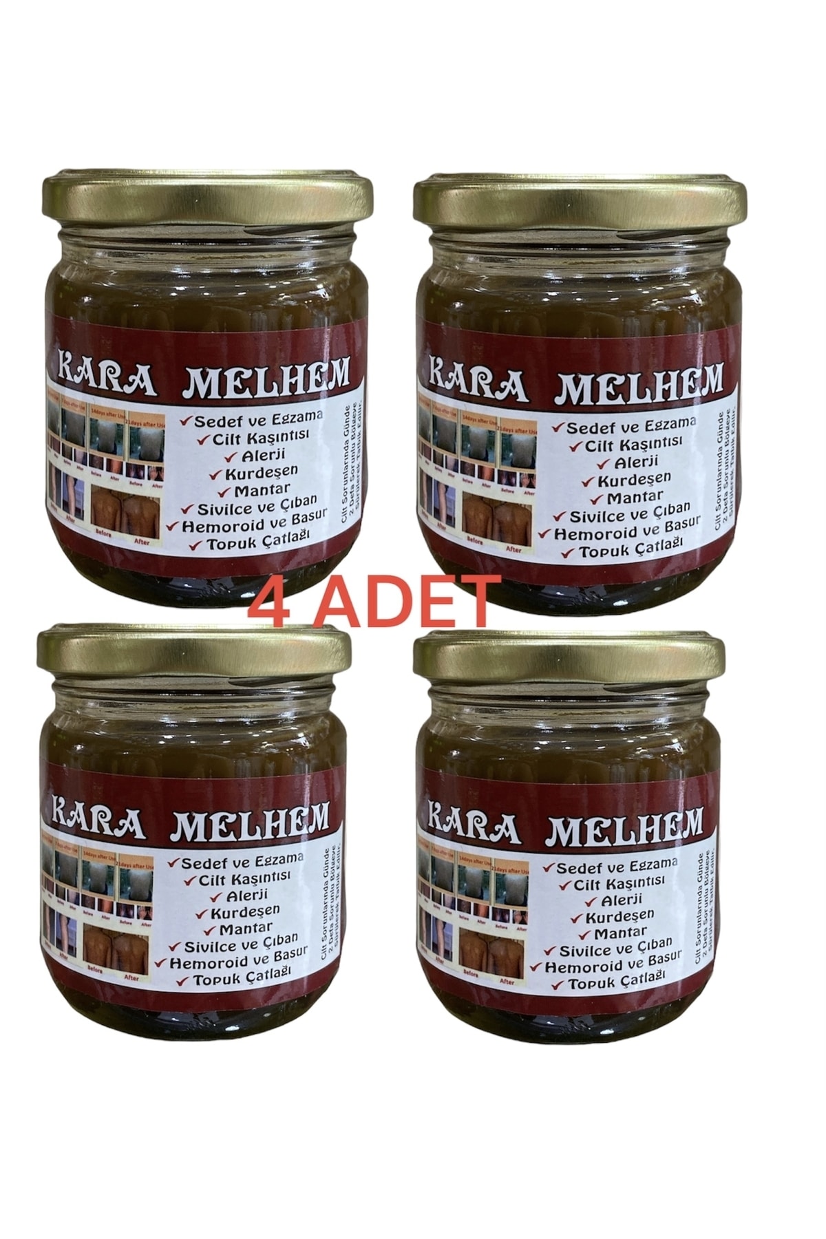 Çağlayan Aktar Yöresel Ürünler Kara Melhem Kremi Kaşıntı Alerji Kurdeşen Mantar. X 4 Adet