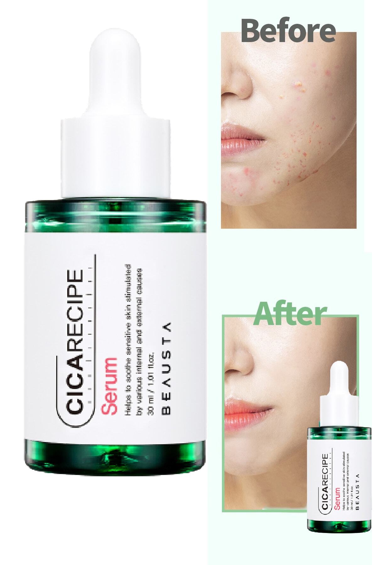 BEAUSTA Cica Centella Içeren Yatıştırıcı Karşıtı Serum – Hassas Ciltler Için Özel Bakım