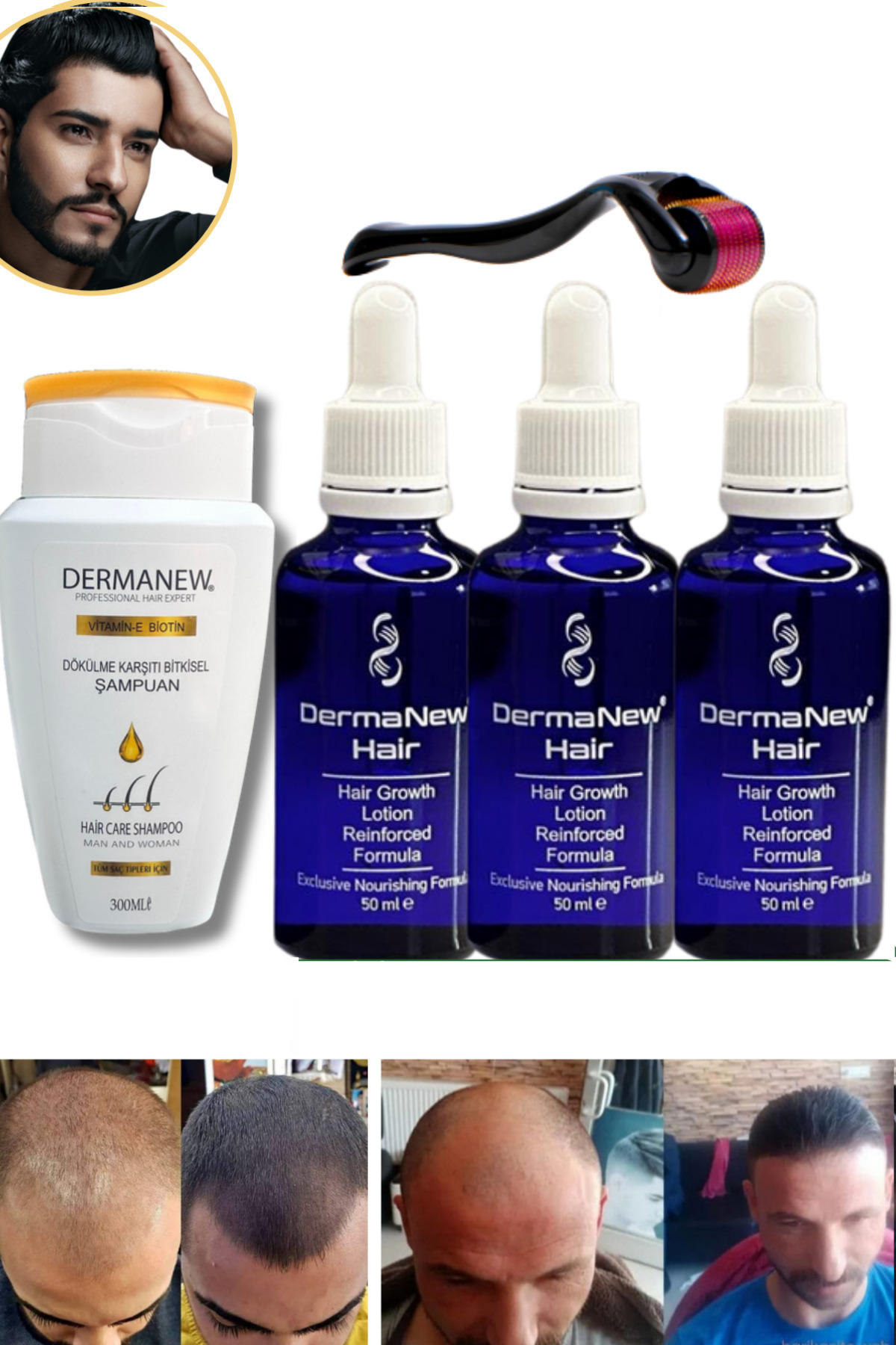 dermanew hair sac serumu sac bakim yagi3 Adet Serum + Roller + Şampuan