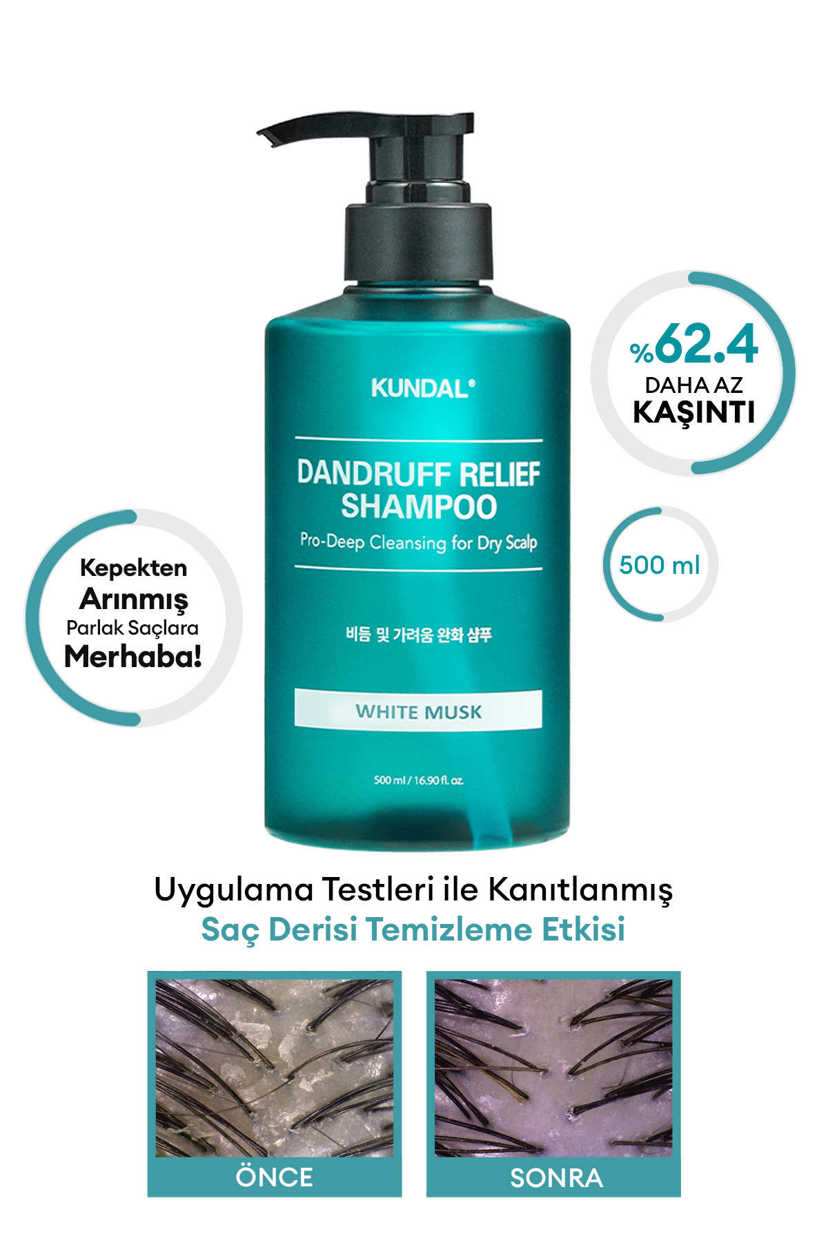 Kundal Kepek Karşıtı Giderici Arındırıcı Bakım Şampuanı Dandruff Relief Shampoo (WHİTE MUSK)