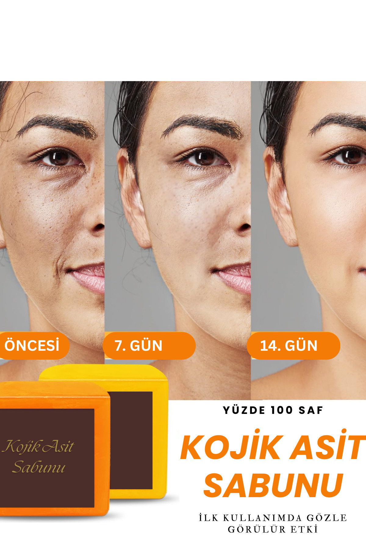 VERANT Yüksek Asit Oranlı Kojic Asit Sabunu (Zerdeçal Ve Kojik Asit) Leke Karşıtı Kojik Asit Sabunu