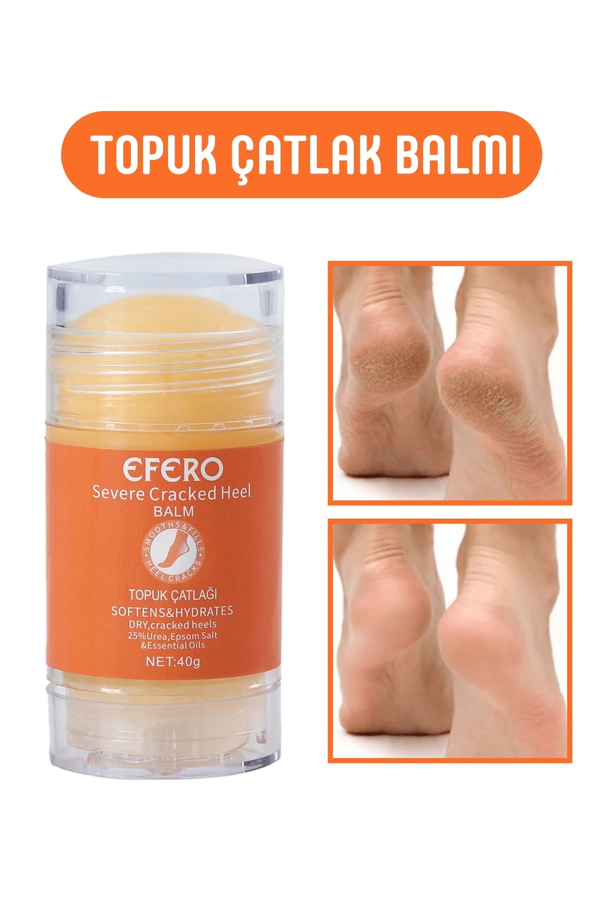 efero Kuru Ve Yıpranmış Ayaklar & Topuklar İçin Ayak Ve Topuk Kremi 40g