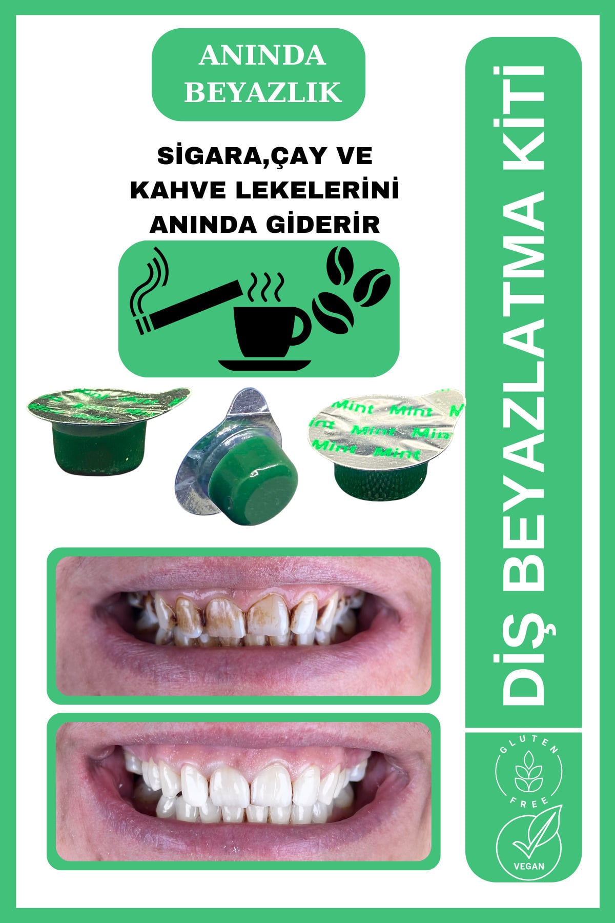 AVANT DENTAL SUPPLY 3 Tüp Diş Beyazlatıcı Nane Aromalı Sigara Çay Kahve Lekesi Için Profesyonel Bakım(3 AYLIK)