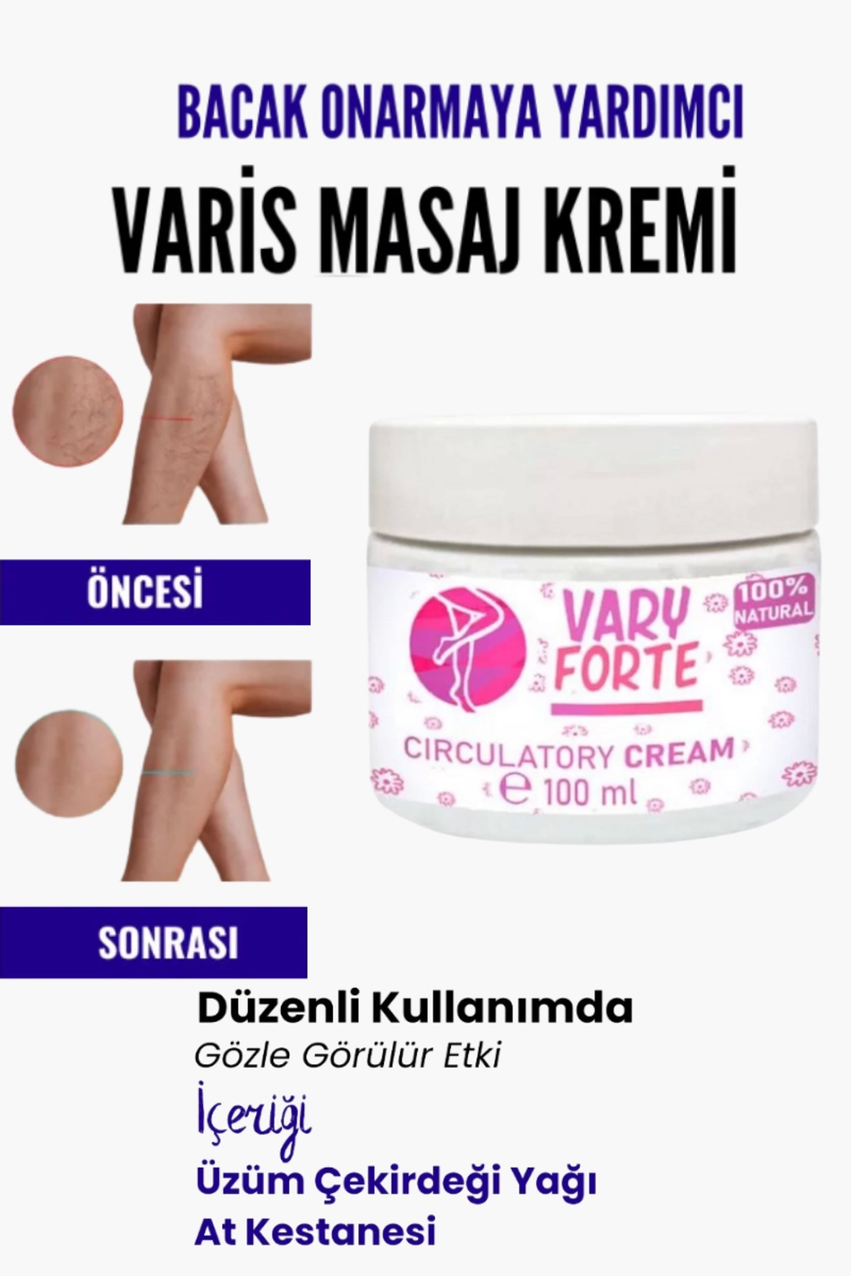 Alleben Var.is Bölgesi Için Bacak Onarmaya Yardımcı Ve Besleyici Varyforte Masaj Kremi 100 ml