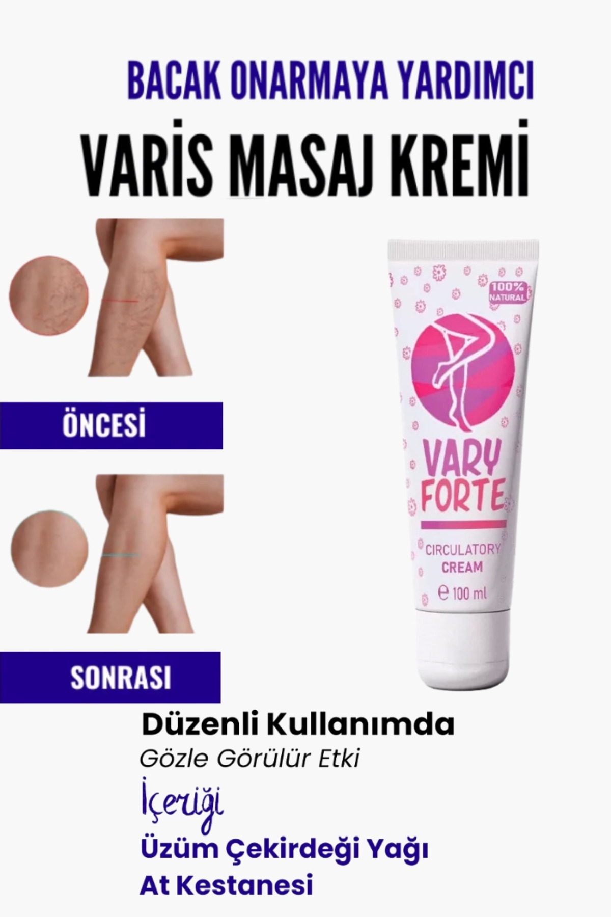 Alleben Var.is Bölgesi Için Bacak Onarmaya Yardımcı Besleyici Varyforte Masaj Kremi 100ml