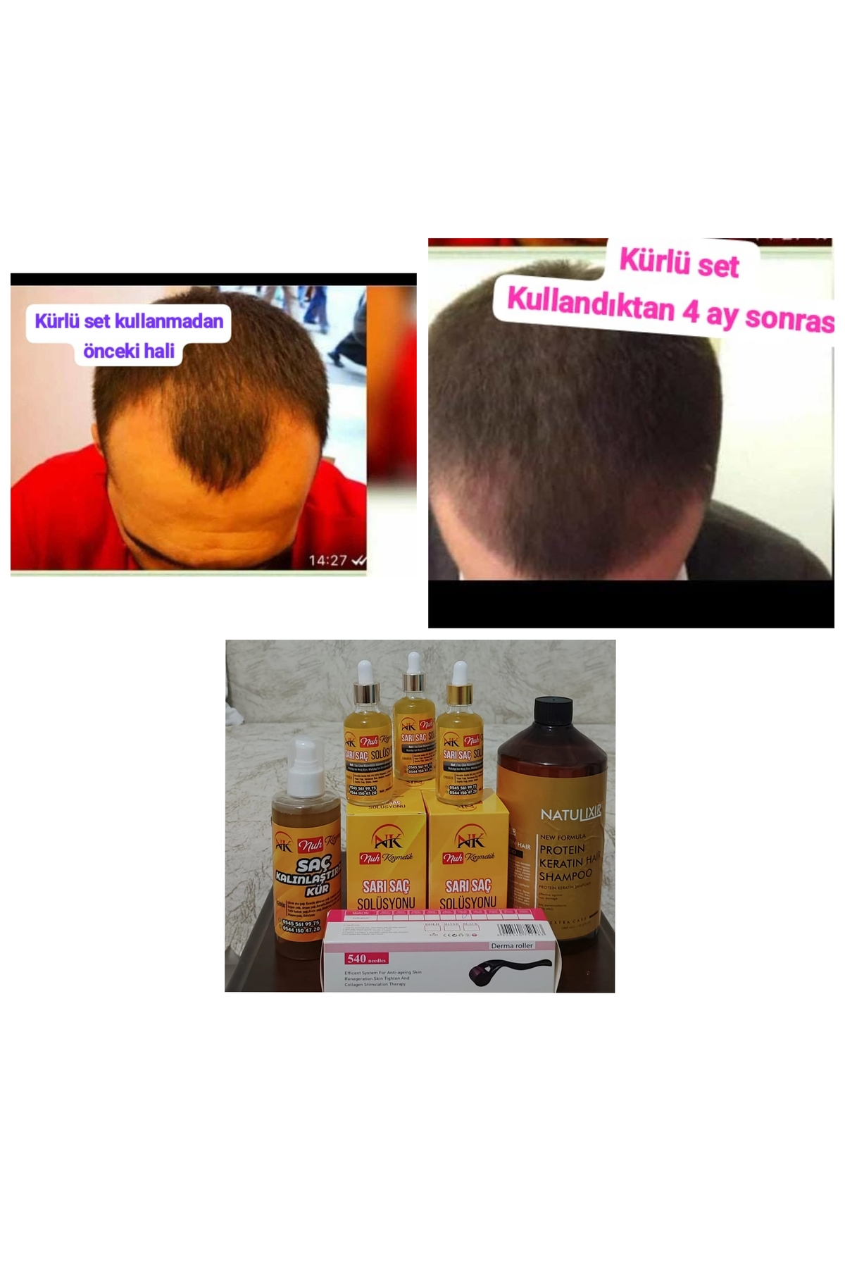 NUH KÜRLÜ SET