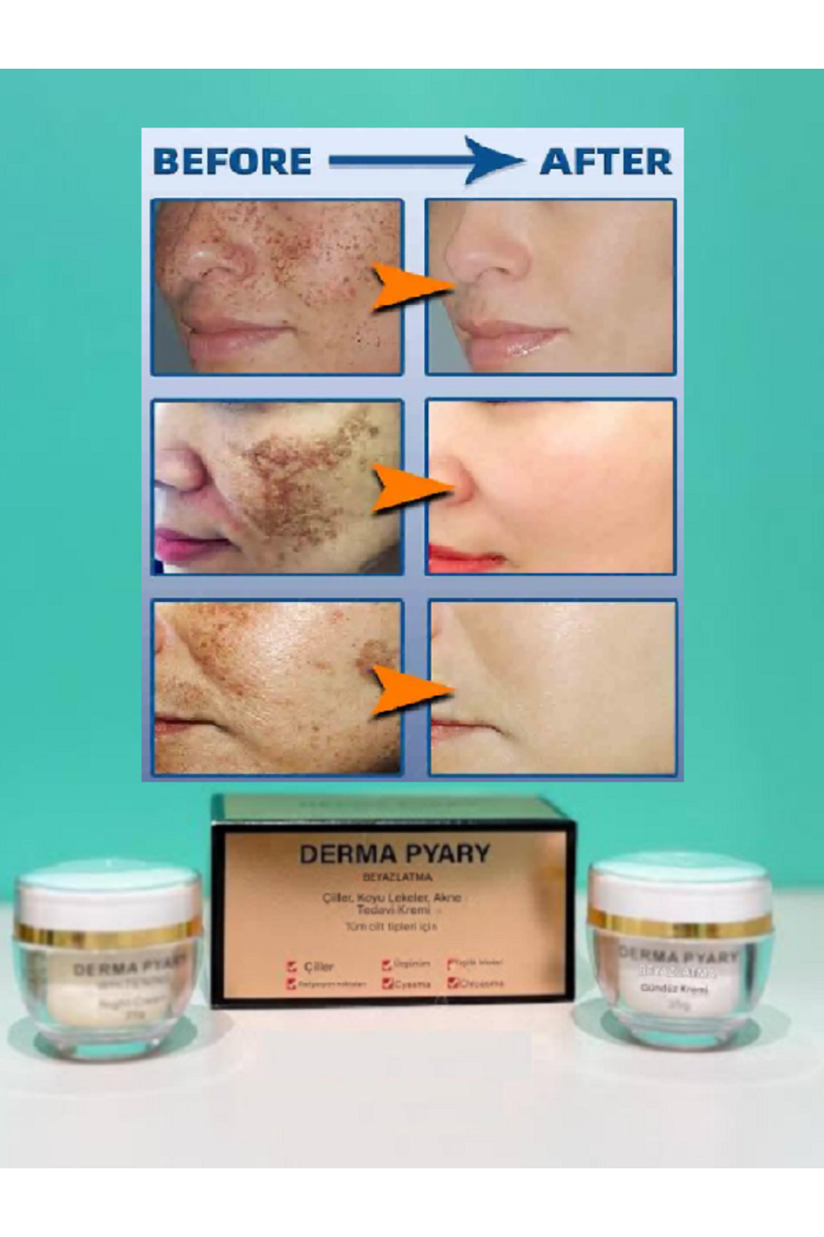 Çil- Güneş Yanığı - Kloazma - Radyasyon Noktaları - Cyasma Karşıtı Beyazlatıcı Yaşlanma Karşıtı Krem