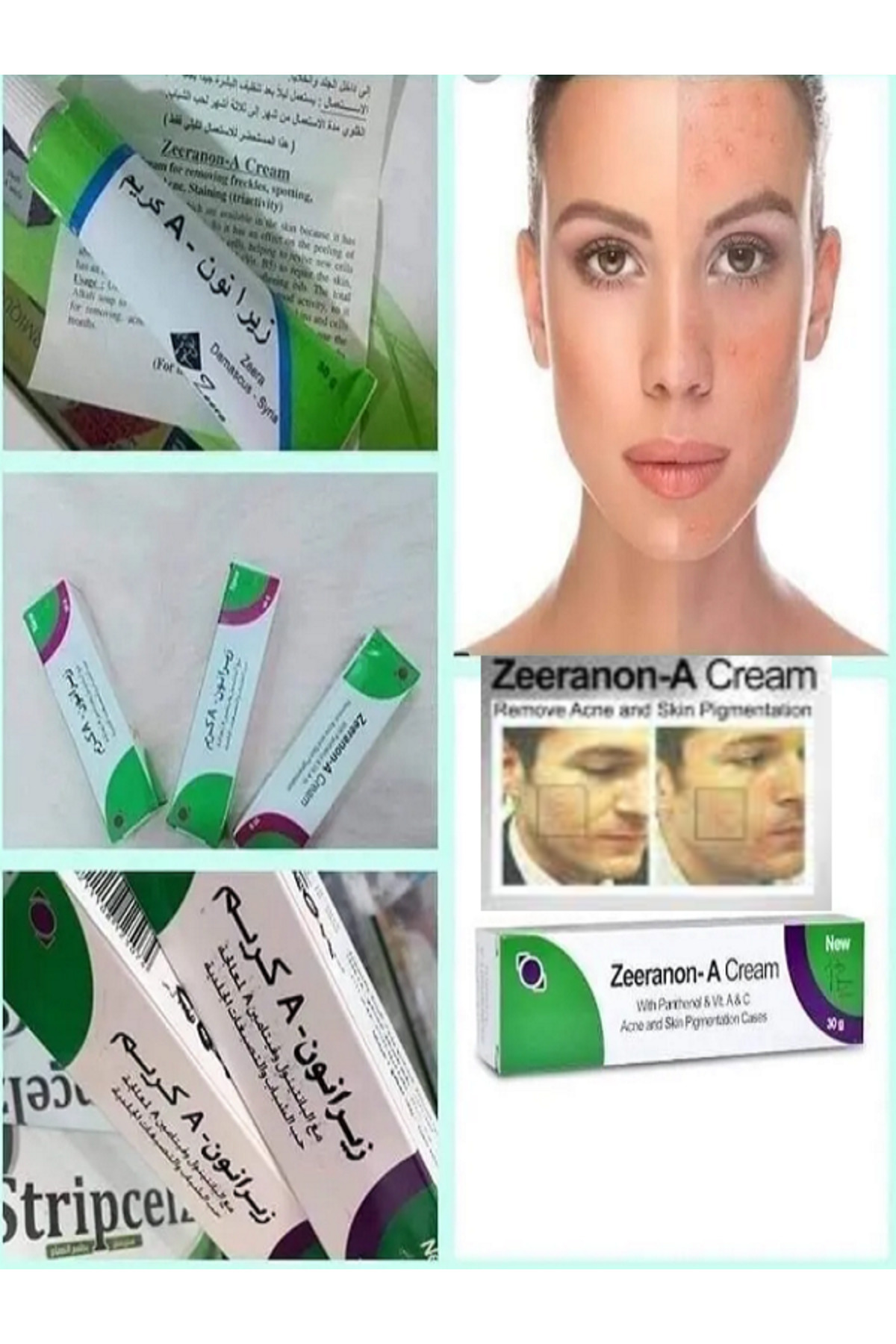 zeeranoon-A Beauty Anti Age Akne Ve Cilt Kusurları Ve Ölü Hücre Yeniliyici kızarıklık Giderici Güzellik Kremi