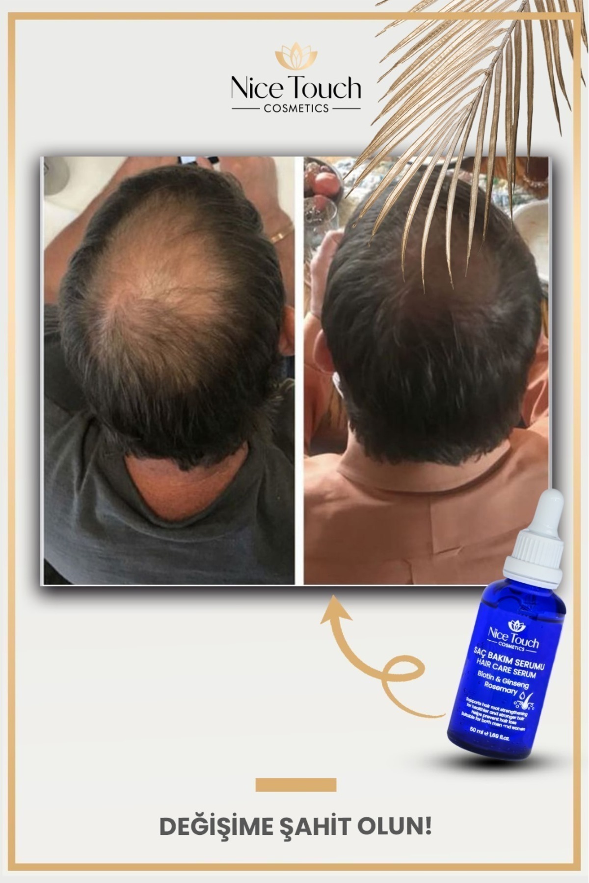 Nice touch Saç Bakım Serumu Gürleştirici Güçlendirici Serum 50ml