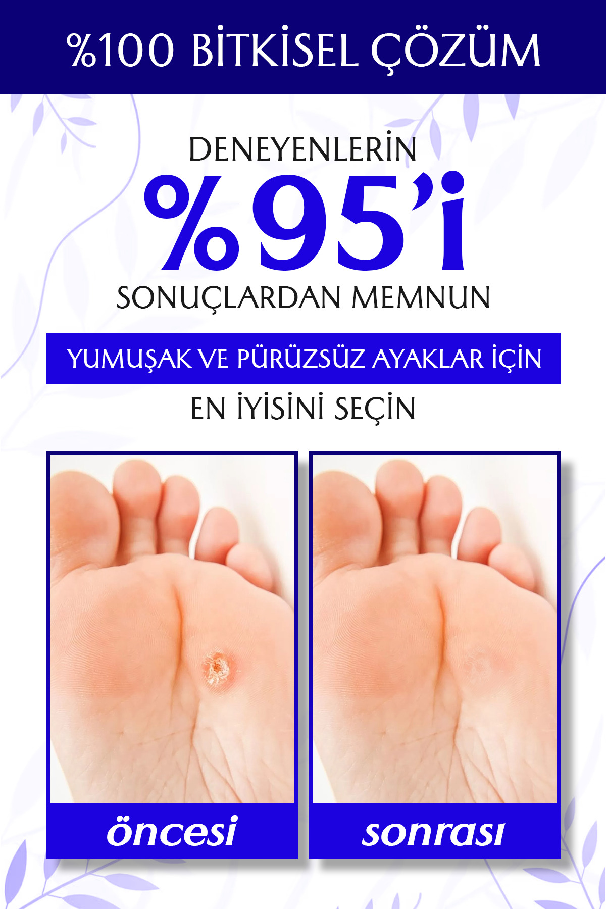 Kırkağa NasırSök El & Ayak İçin Yoğun Bakım Solüsyonu – Sertleşmiş Ciltler İçin Özel Formül 20 ml