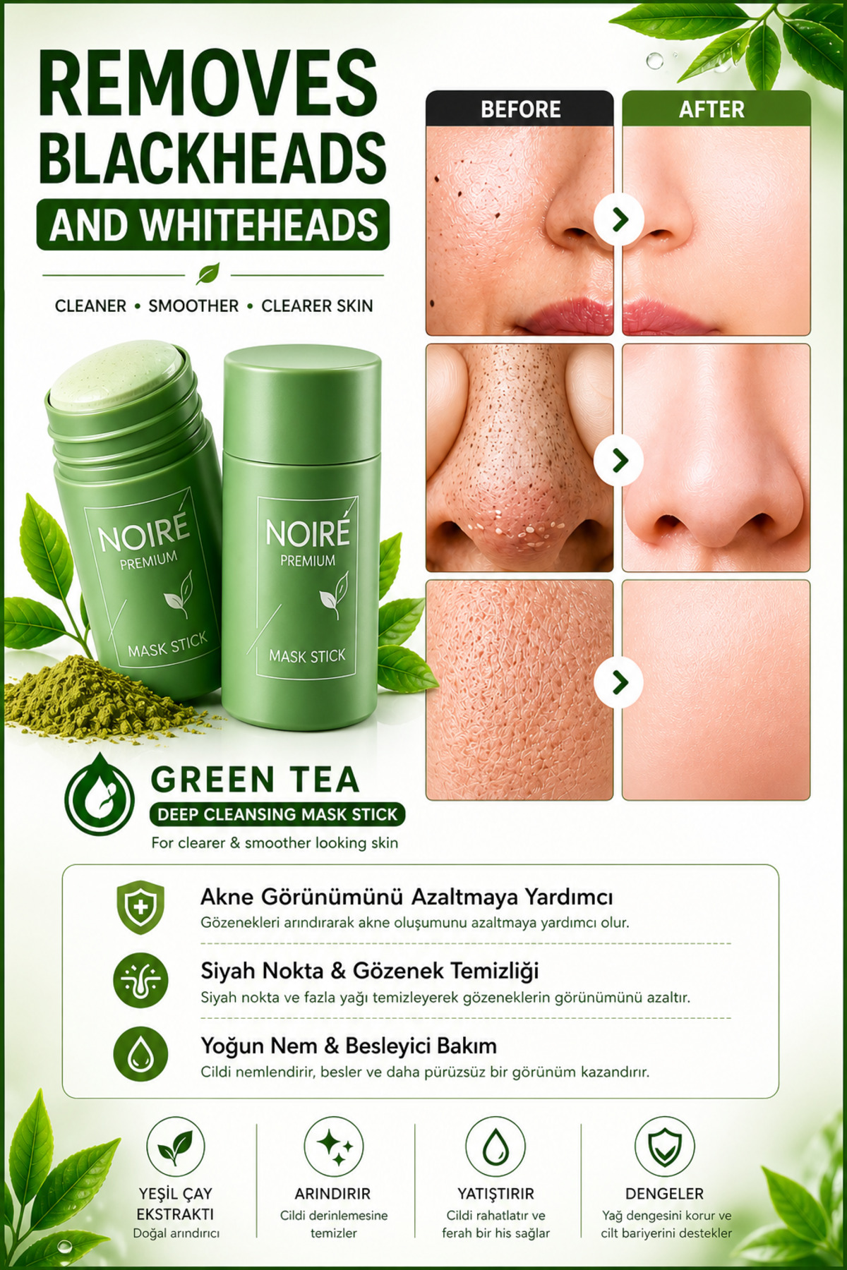 NOIRE PREMIUM Yeşil Çay Özlü Siyah Nokta ve Akne Maskesi & Green Tea Extract Acne and Pimple Mask