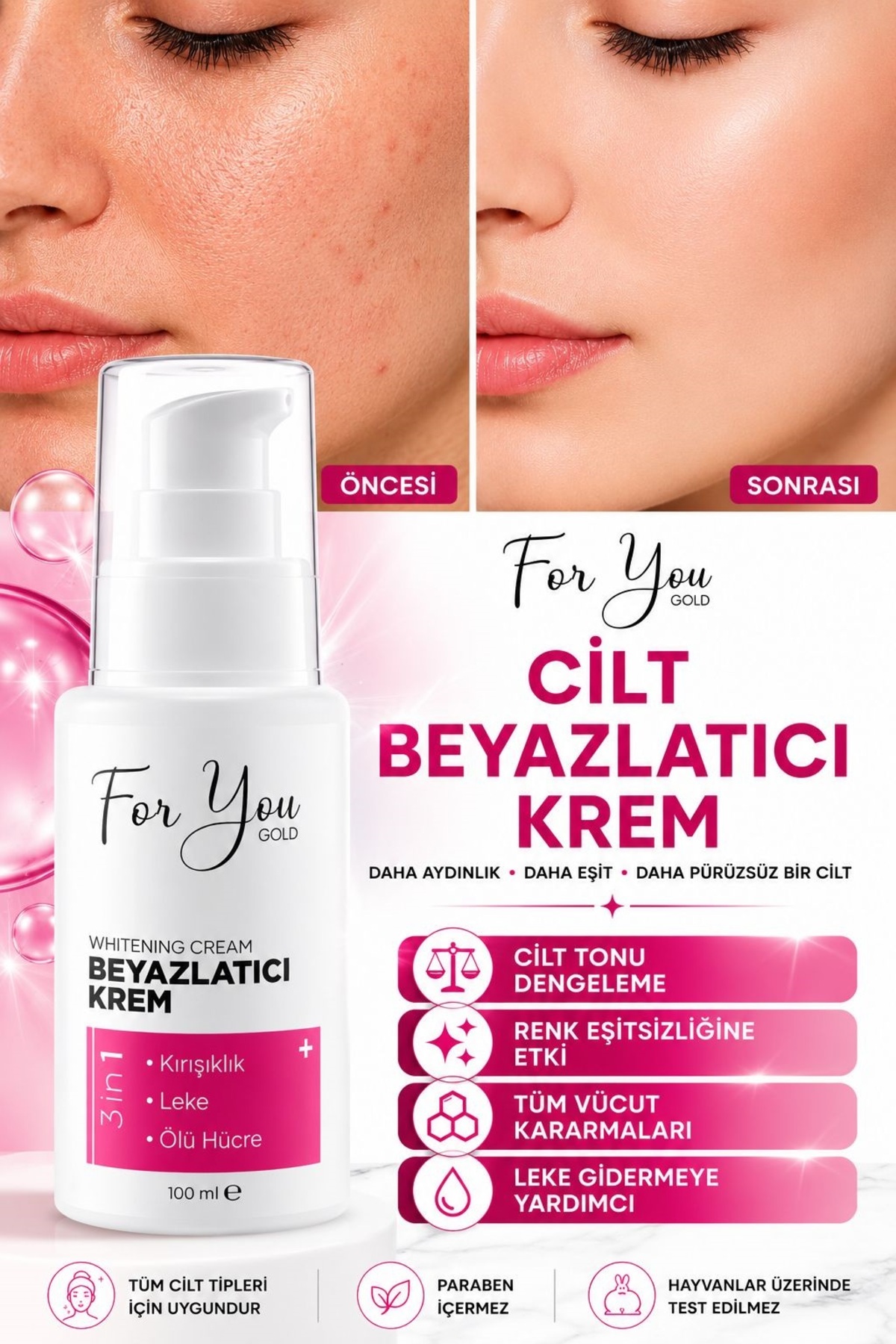 For You Gold Cilt Beyazlatıcı Krem (Kararma Karşıtı - Ton Eşitleyici - Renk Açıcı Krem)