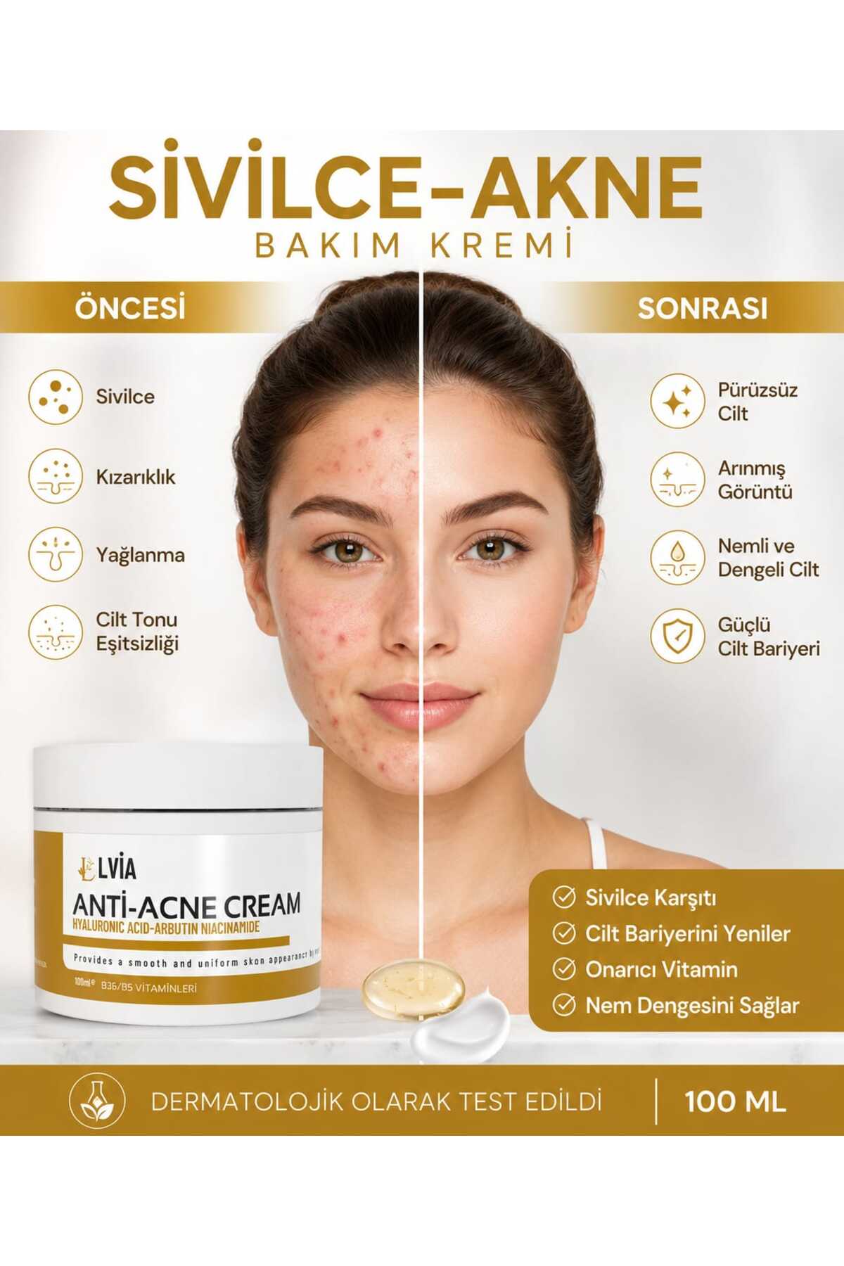 LVİA Vitamin İçeren Sîvîlce Önleyici Krem Siyah Nokta Sîvîlce - Âkne Karşıtı, Lèke Giderici Yüz Kremi