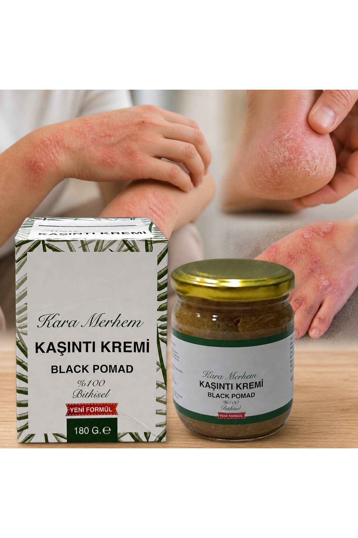 sarayli baharat Ardıç Katranlı Egzema Mantar Kremi 150 Ml Özel Üretim